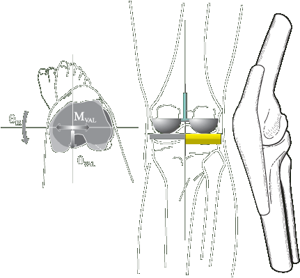 ACL Research